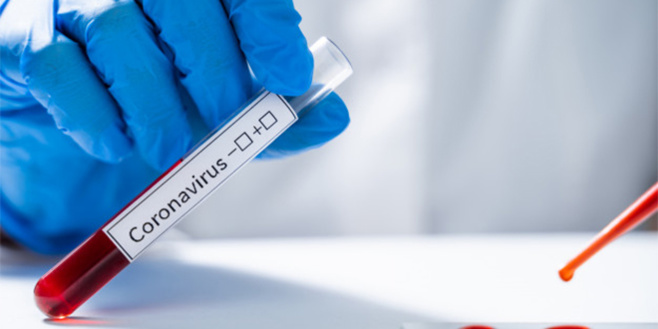 Coronavirus : plus d'un million de morts dans le monde et aucun signe de ralentissement. © DR