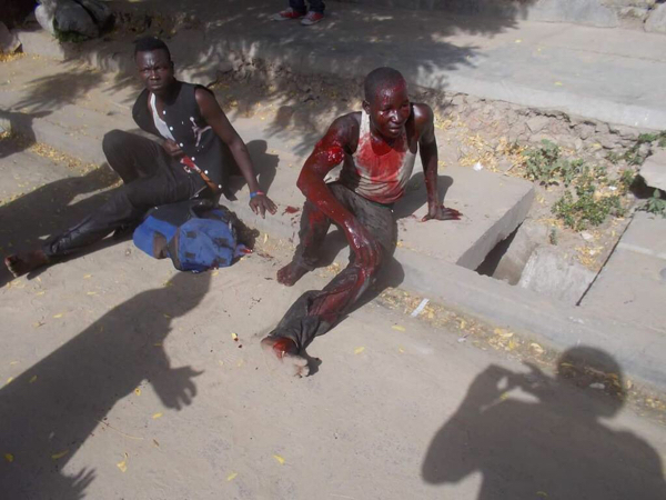 Tchad : les premières images des blessés de l'explosion 