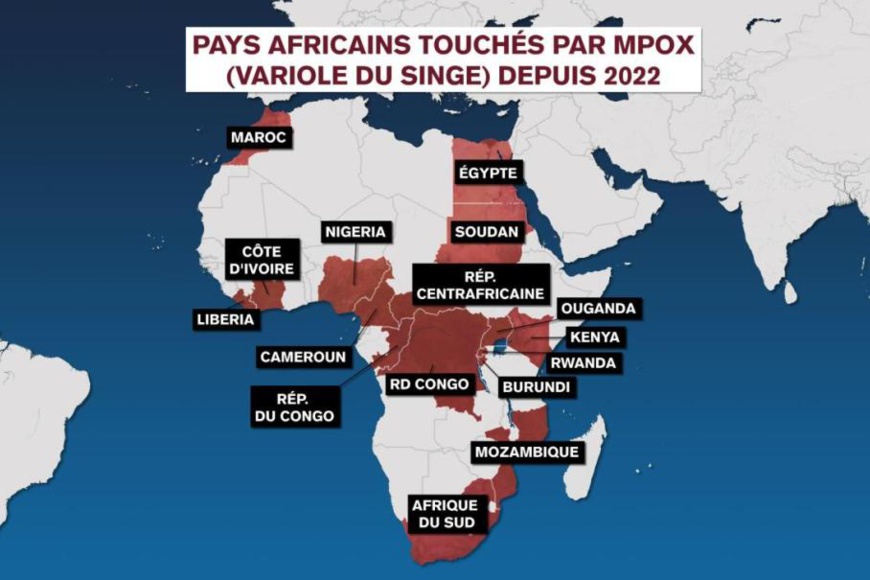 © TV5MONDE © TV5MONDE