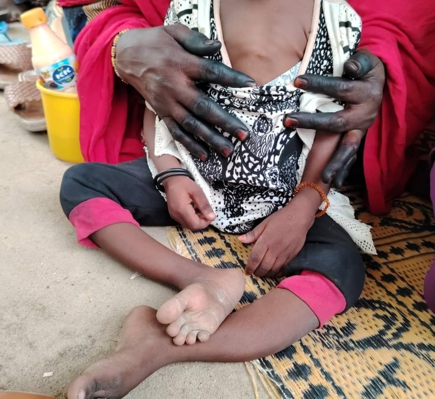 La lutte contre la polio, une priorité vitale pour le Bassin du Lac-Tchad et le Tchad