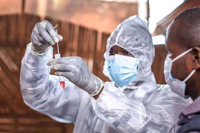 Santé : La RDC confirme ses deux premiers cas de Mpox Clade IIb