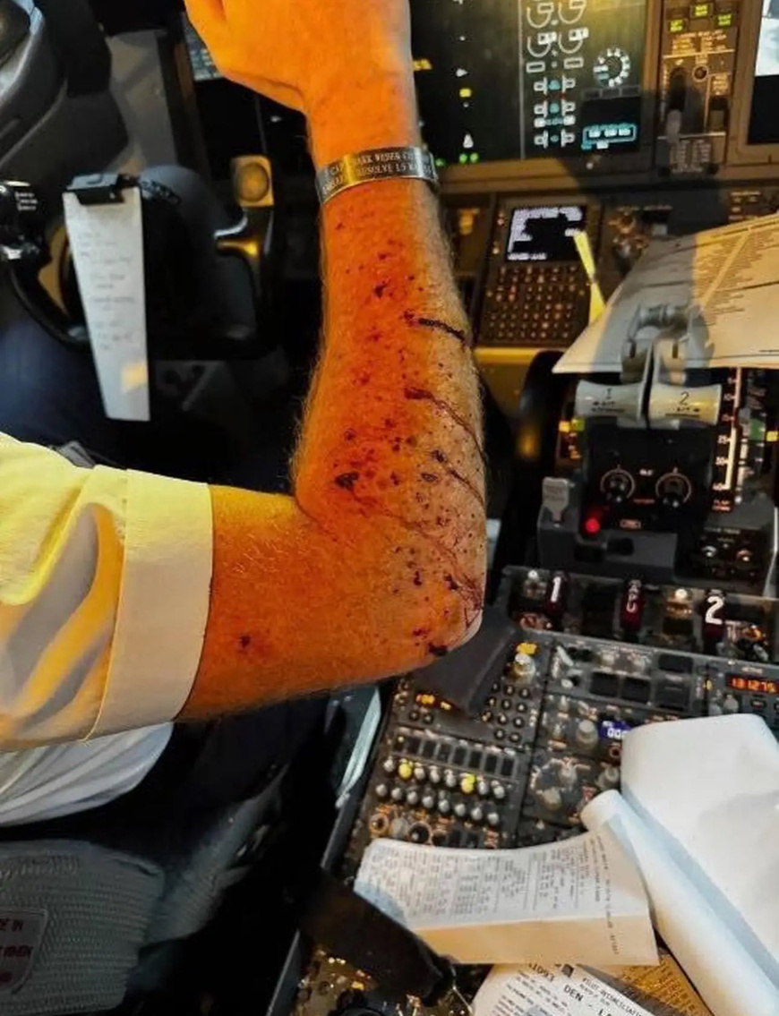 USA : Pare-brise de 737 MAX fissuré à 36 000 pieds, pilote blessé USA : Pare-brise de 737 MAX fissuré à 36 000 pieds, pilote blessé