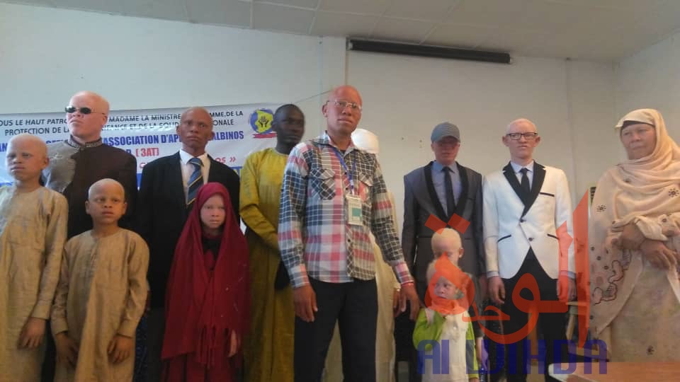 Tchad : les albinos demandent une meilleure considération de l'Etat. © Alwihda Info/M.M.