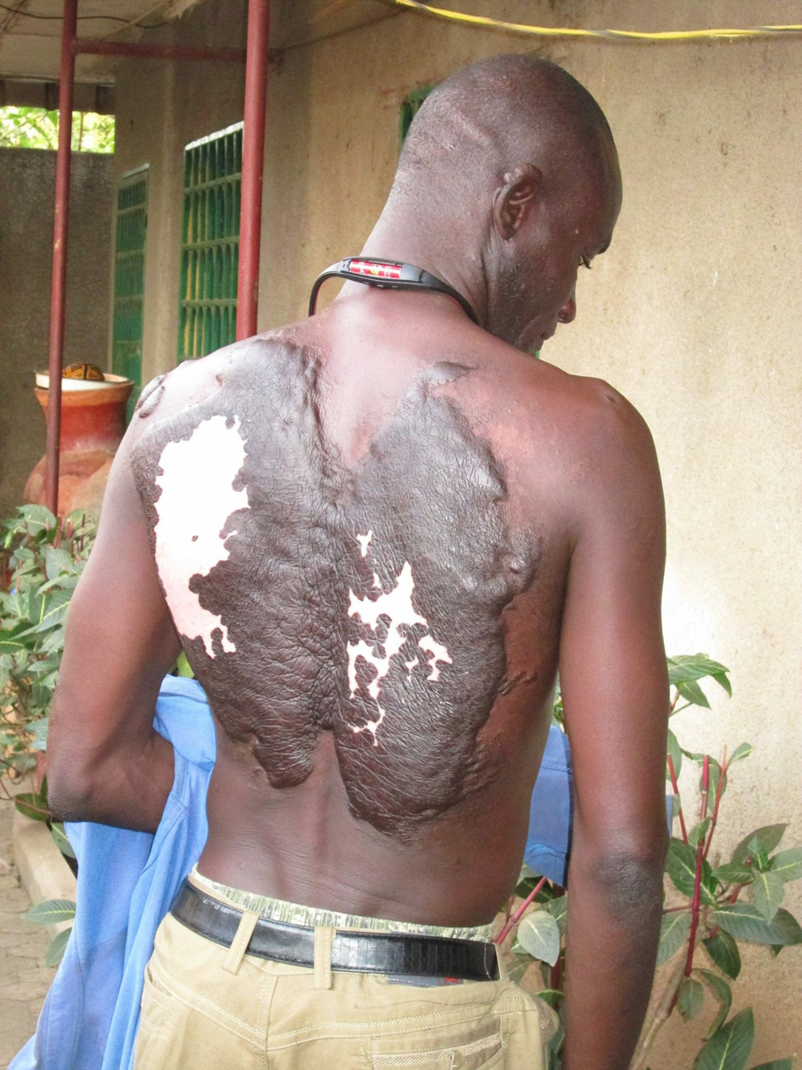 L'étonnant récit d'un jeune tchadien rescapé d'une attaque de Boko Haram