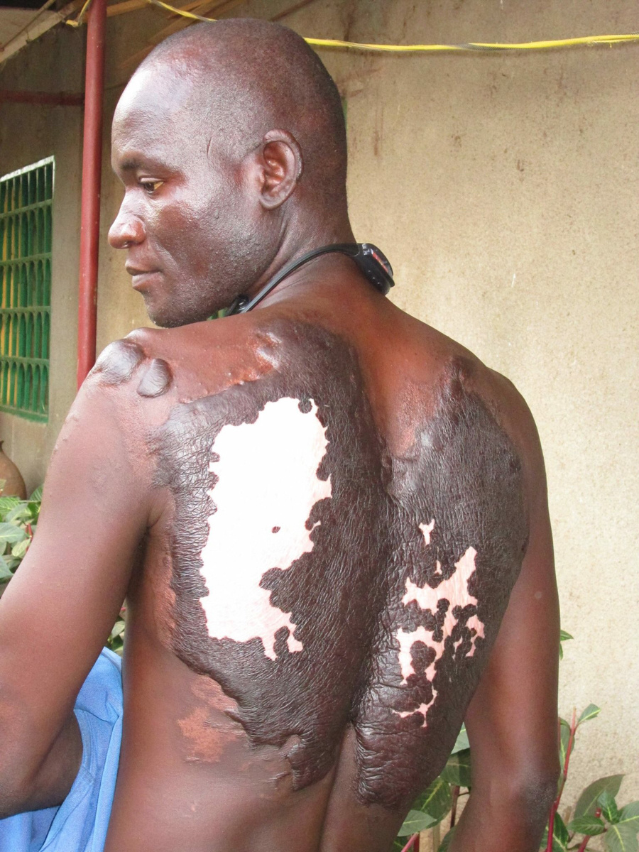 L'étonnant récit d'un jeune tchadien rescapé d'une attaque de Boko Haram