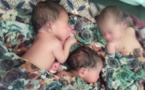 Tchad : une femme donne naissance à des triplés à Abéché