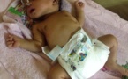 Centrafrique : Ce bébé de 3 jours a survécu à une attaque à la machette