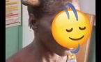 Mandoul (Tchad) : Une femme développe une corne, entre croyances et nécessités médicales