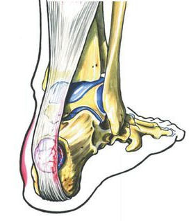 Une blessure... c'est toujours trop long...