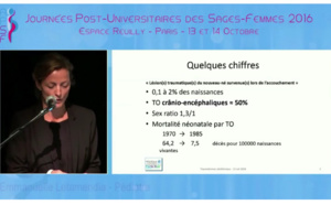 Les traumatismes au niveau du crâne - E Letamendia