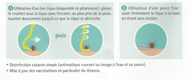 La technique de morsure de la tique La technique de morsure de la tique