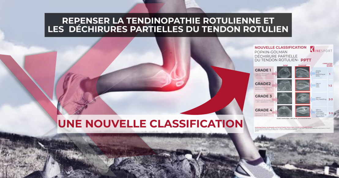 ​Repenser la tendinopathie rotulienne et les lésions partielles du tendon rotulien: Un nouveau système de classification