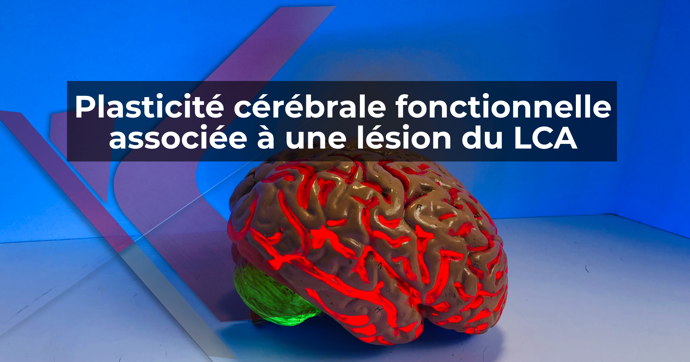 Plasticité cérébrale fonctionnelle associée à une lésion du LCA