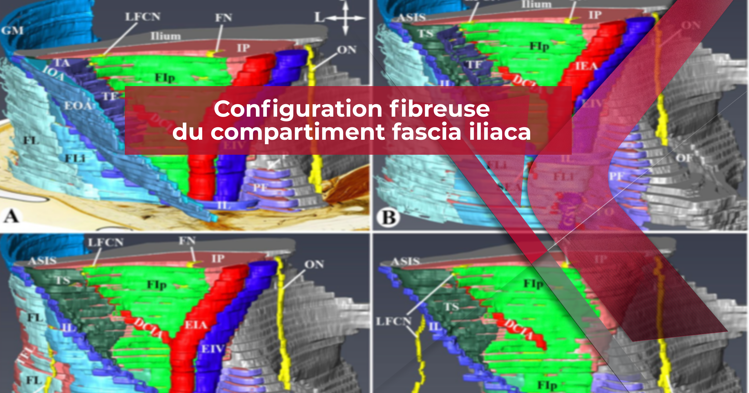 Configuration fibreuse du compartiment fascia iliaca par plastination