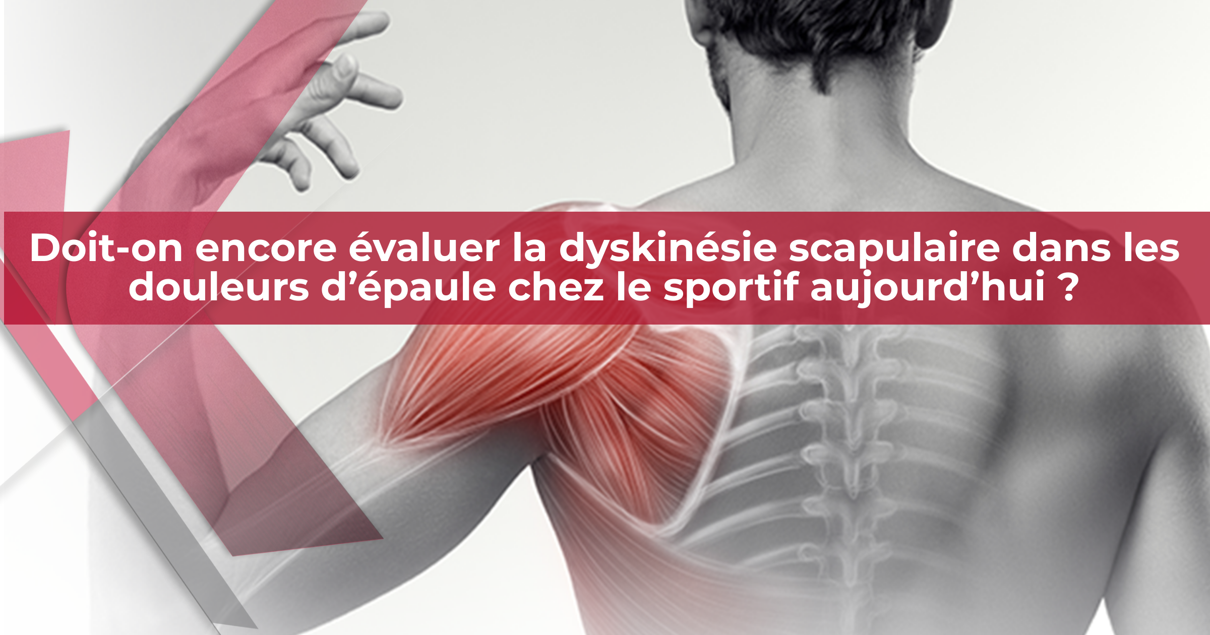   Doit-on encore évaluer la dyskinésie scapulaire dans les douleurs d’épaule chez le sportif aujourd’hui ?    