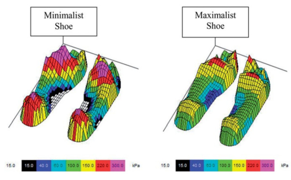 Comparaison des forces plantaire lors de la course entre des chaussures minimaliste et maximaliste