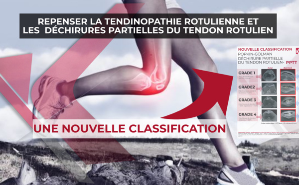 ​Repenser la tendinopathie rotulienne et les lésions partielles du tendon rotulien: Un nouveau système de classification