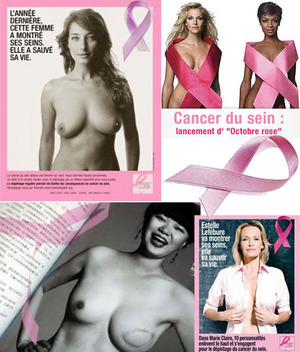 dépistage du cancer du sein