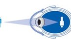 La vérité à propos de la chirurgie des yeux au laser
