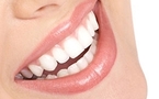 Hygiène bucco-dentaire : une bouche saine pour un sourire radieux