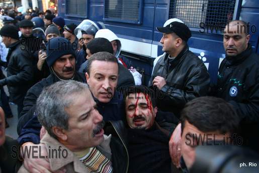 Le député du RCD Athmane Mazouz  blessé à la tête