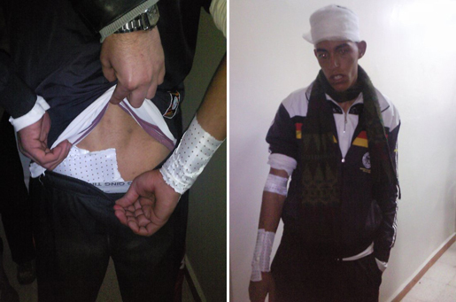 L'un des jeunes violentés par les gendarmes algériens à Chorfa (Photo DR)