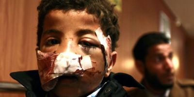 Enfant blessé à Misrata (PHOTO: REUTERS)