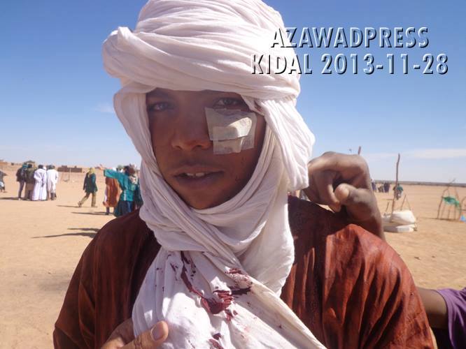 L'armée malienne a également ouvert le feu sur cet adolescent (PH/AzawadPress)
