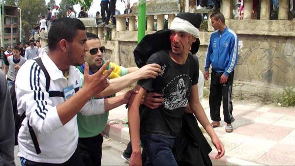Manifestant kabyle blessé ce dimanche 20 avril par les forces de répression algériennes à Tizi-Wezzu (PH/DR)