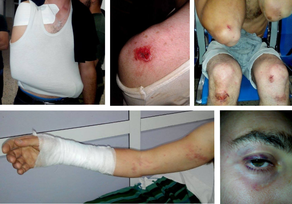 « Un policier était sur le point de tirer sur nous », témoignage des militants arrêtés à Laṛevɛa n At Iraten 