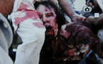 Kadhafi meurt des suites de blessures subies lors de sa capture à Syrte (CNT)