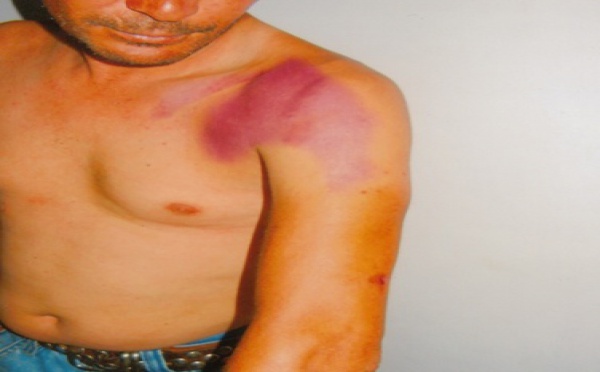 Le non-jeûneur des At Dwala confirme sa première version : le mensonge de la DGSN