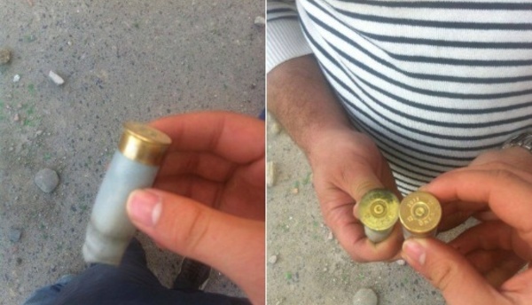 Marche du 20 Avril réprimée à Tizi-Wezzu : un jeune kabyle de 20 ans a perdu un oeil