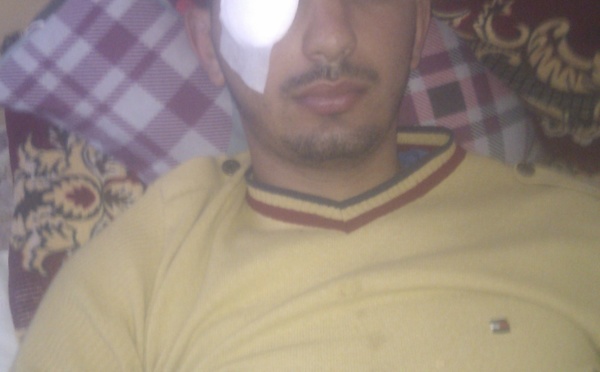 Une délégation du MAK rend visite à Lounis Aliouat, touché à l'oeil lors de la marche du 20 avril