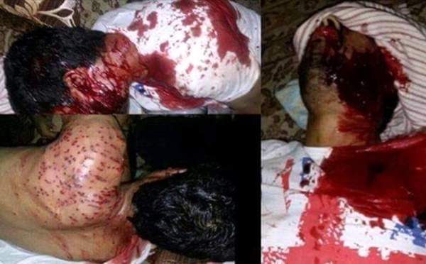 Nouveau SOS du Dr. Kameleddine Fekhar : "Au M’zab… c’est le génocide !!"