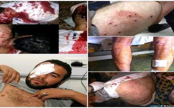  Massacre en cours dans les cités millénaires du Mzab / Une trentaines de morts et plus de 300 blessés par balles