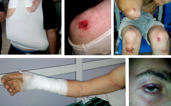 « Un policier était sur le point de tirer sur nous », témoignage des militants arrêtés à Laṛevɛa n At Iraten 