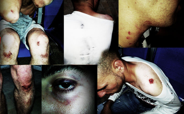 Lancement d'une pétition contre la répression des militants du MAK