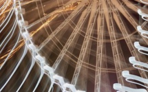 Procès en diffamation : Marcel Campion gagne contre Le Canard Enchaîné