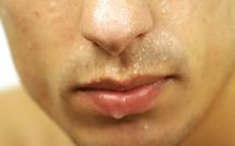 Confondu par sa sueur