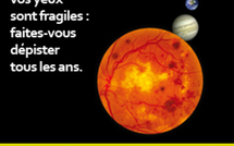 Diabétiques, vous risquez de perdre la vue !