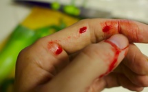 Paris 18e : doigt coupé en escaladant la grille du centre sportif des Fillettes