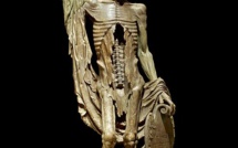 Face à la maladie Covid-19, que choisir en premier