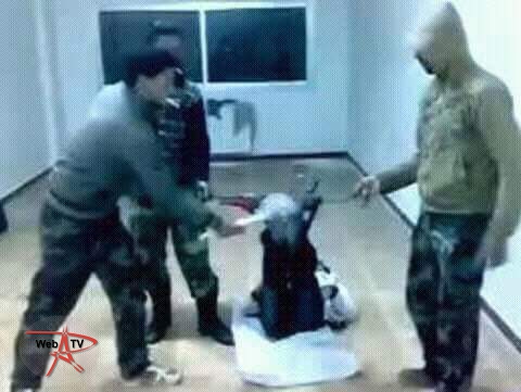 Prisonnier libyen torturé en prison (c) DR