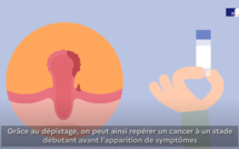 Cancer colorectal : Pourquoi se faire dépister ?